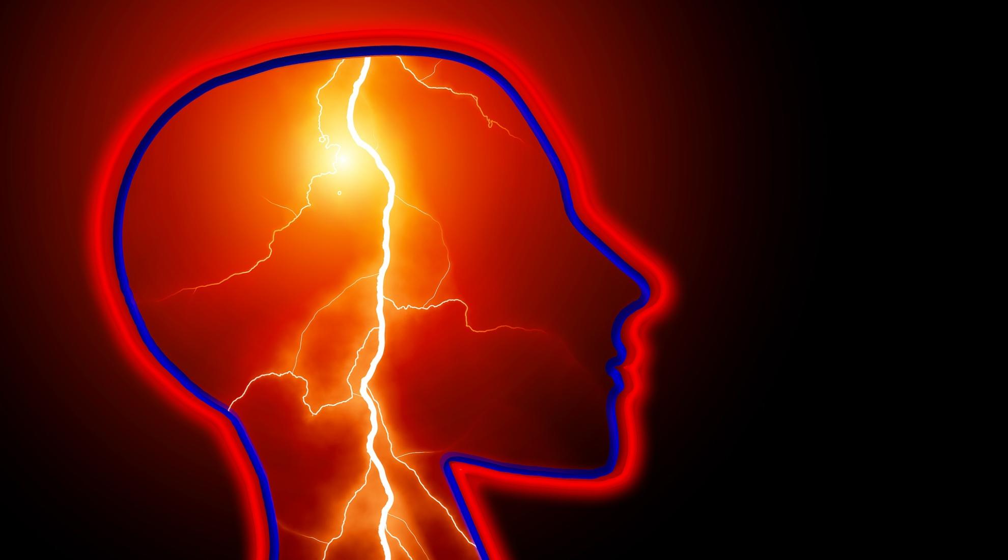 Stroke illustration