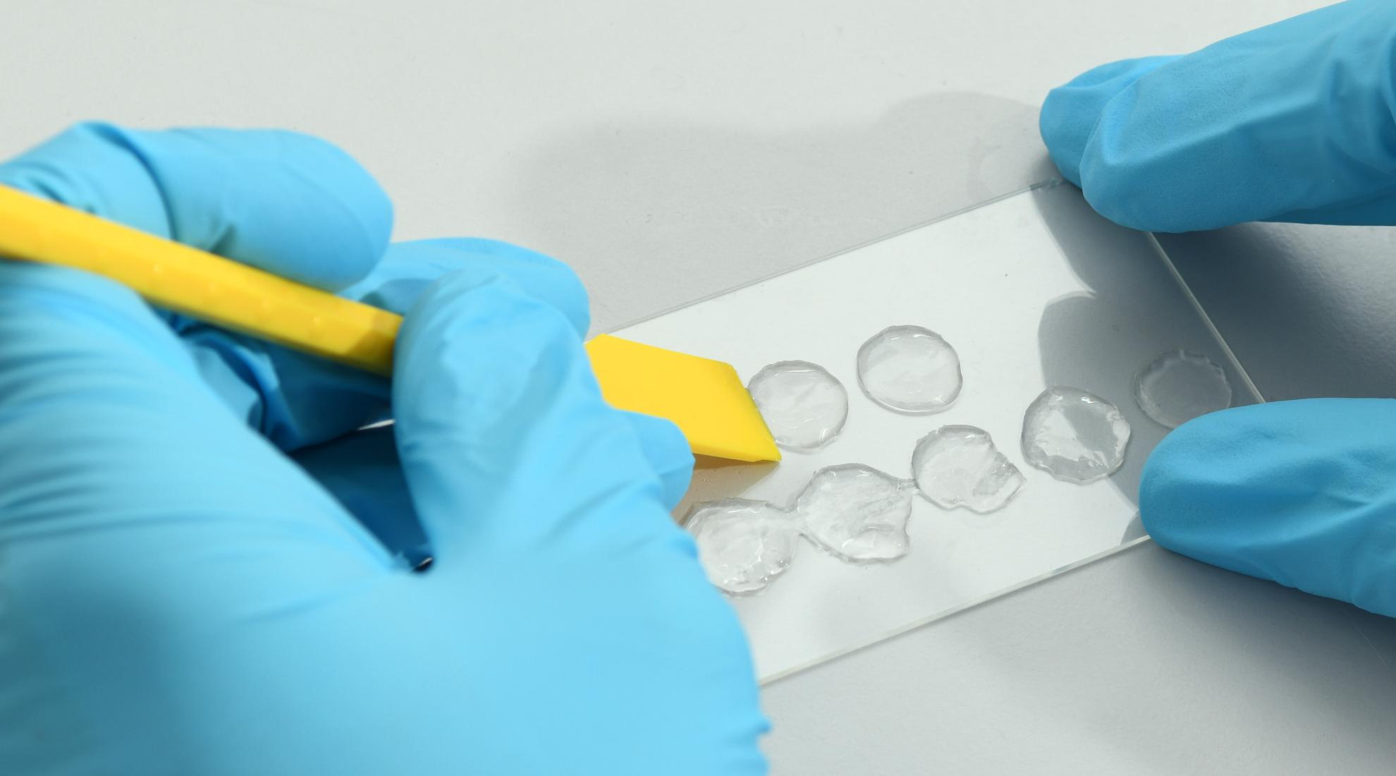 The new 3D skin model will allow scientists to simulate skin diseases and thus better understand them. Source: Empa