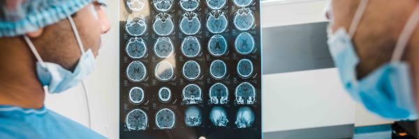 Brain tumour check